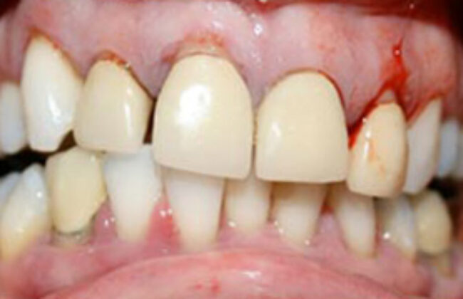 Before