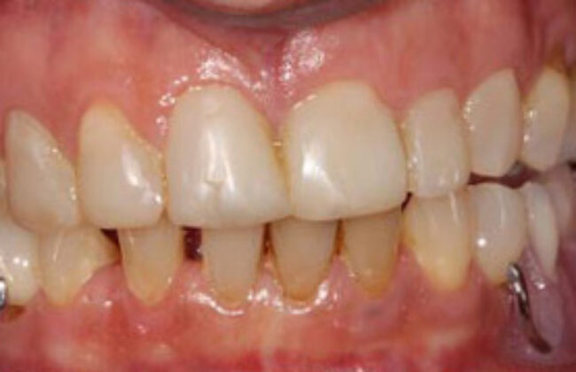 Before