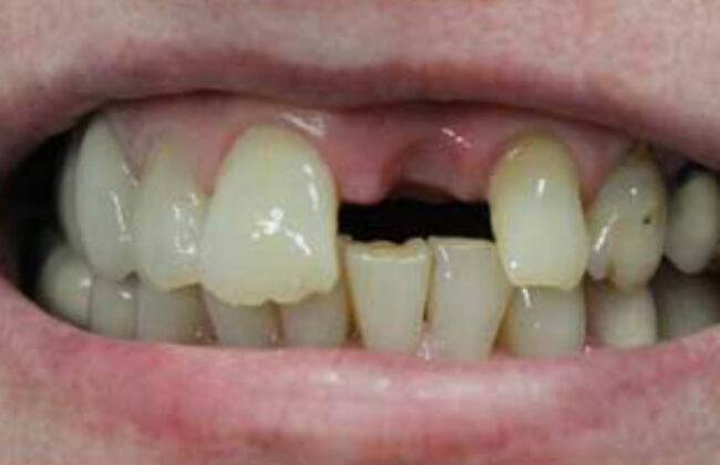 Before