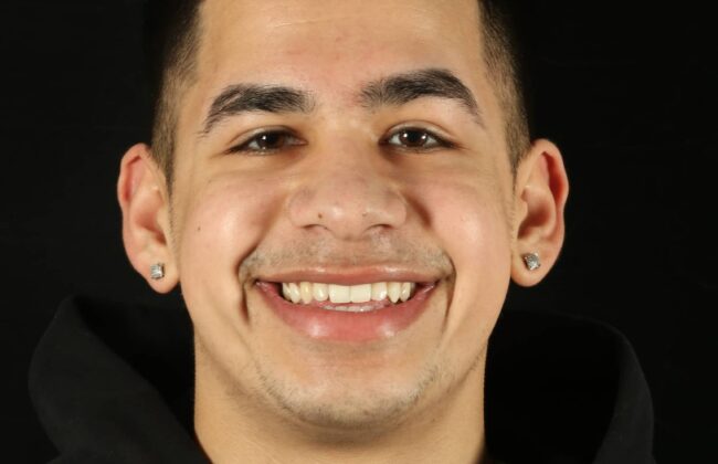 After (Teeth)