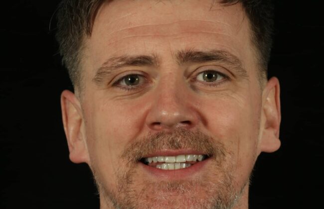 After (Teeth)