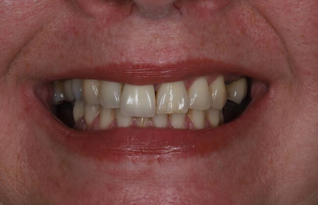 Before
