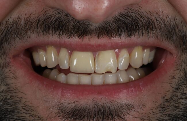Before