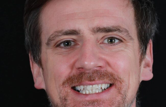 Before (Teeth)