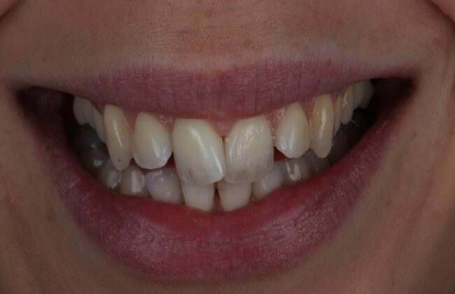 Before
