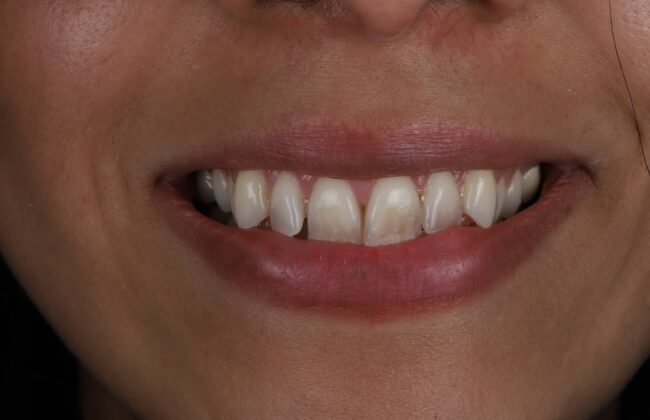 Before