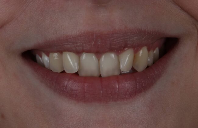 Before