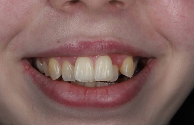 Before