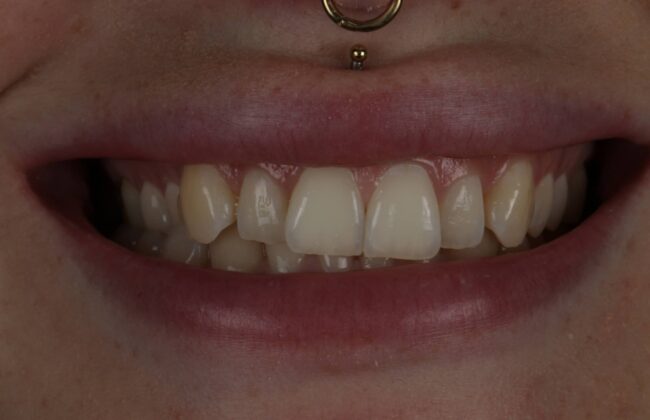 Before
