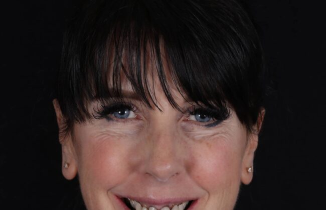 Before (Teeth)