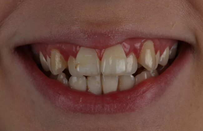 Before