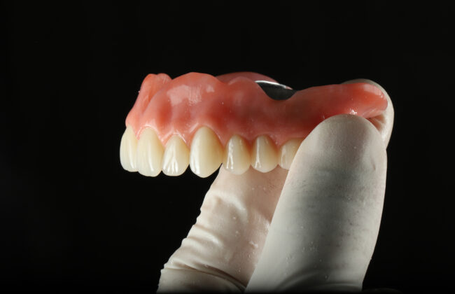 Before (Teeth)