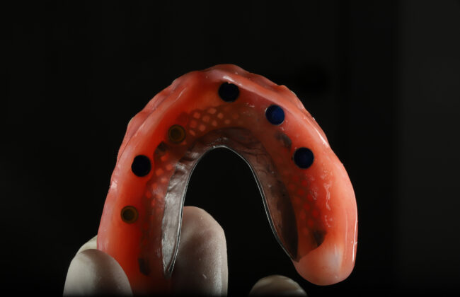 After (Teeth)