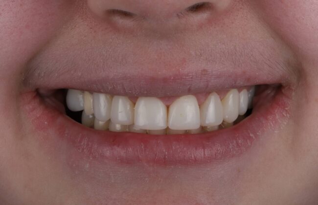 After