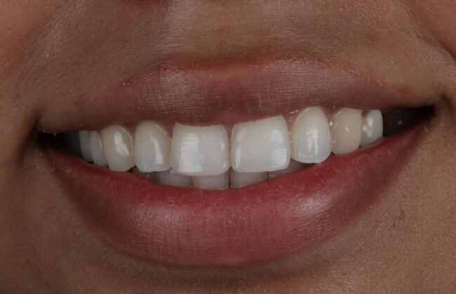 After