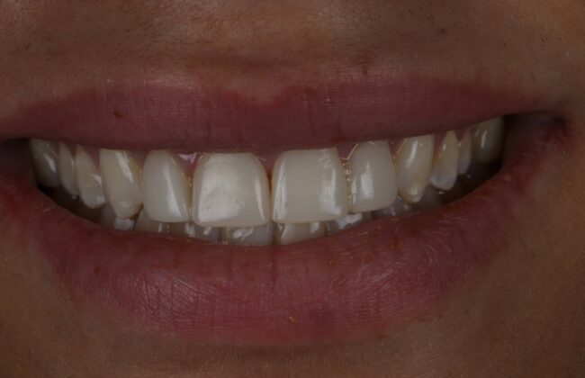 After