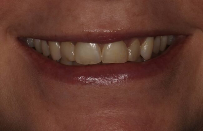 Before