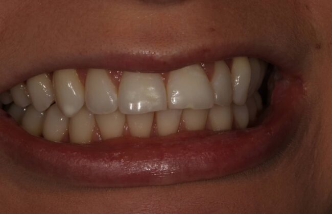 Before