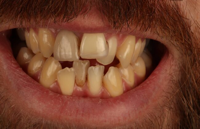 Before