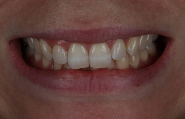 Before