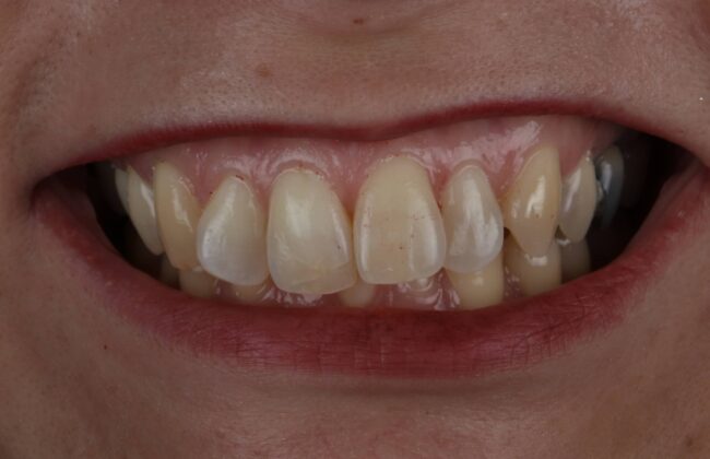 Before