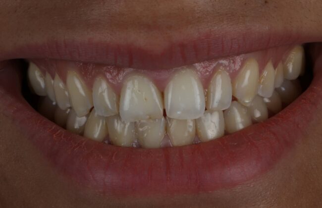 Before