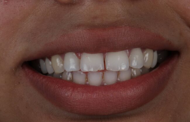 Before