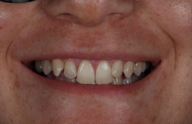 Before