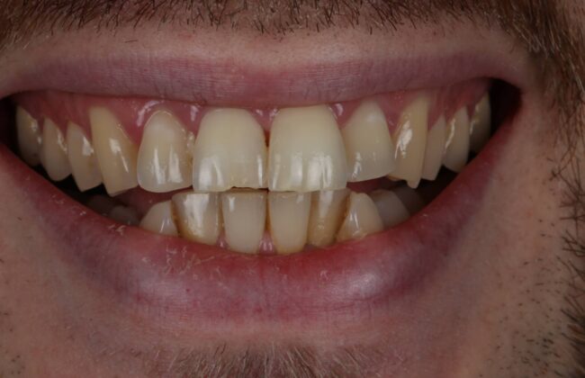 Before