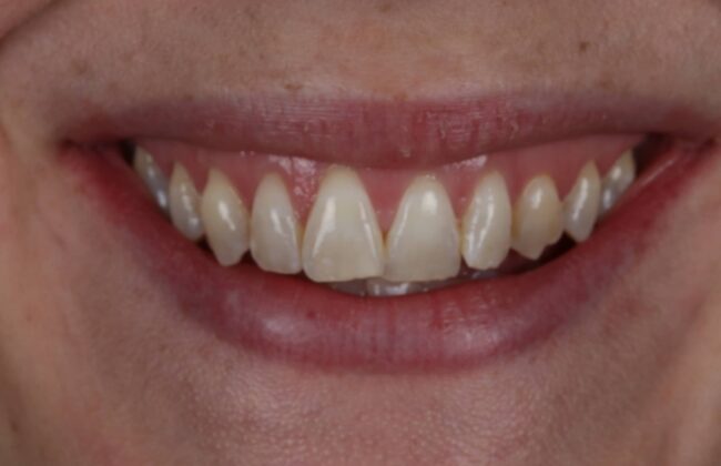 Before