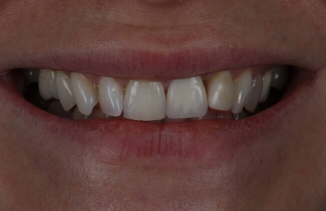 Before