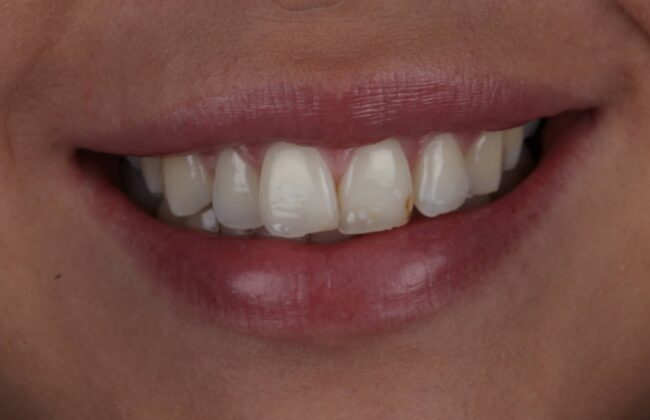 Before