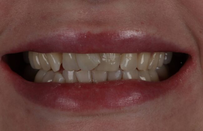 Before
