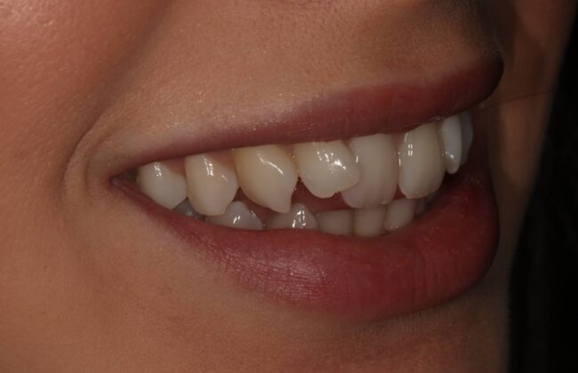 Before