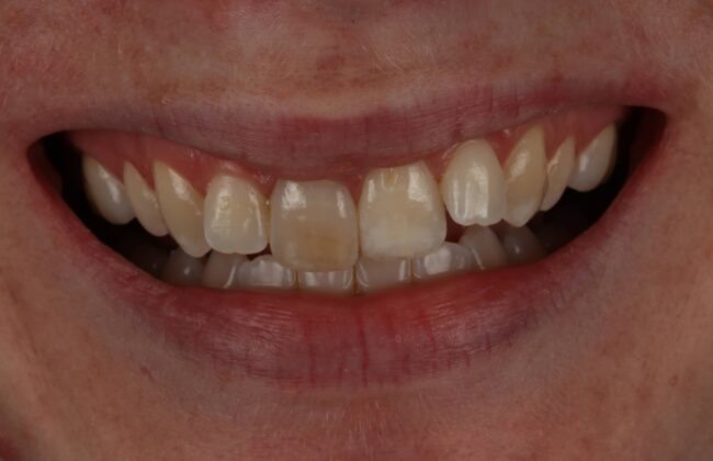 Before