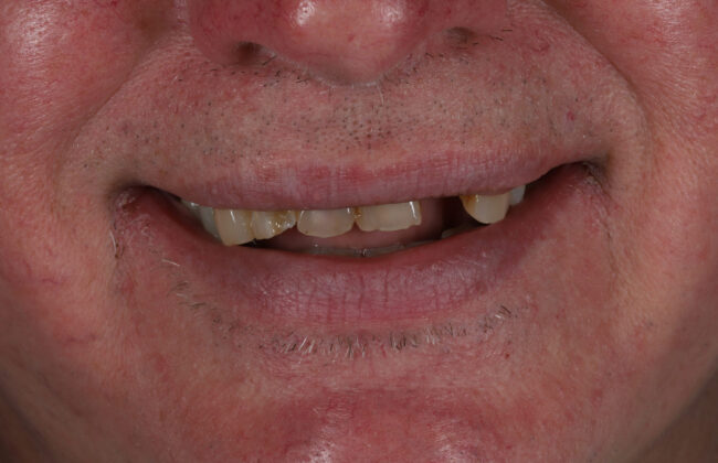 Before