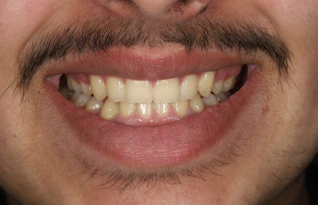 After