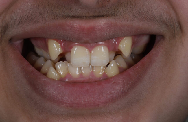 Before