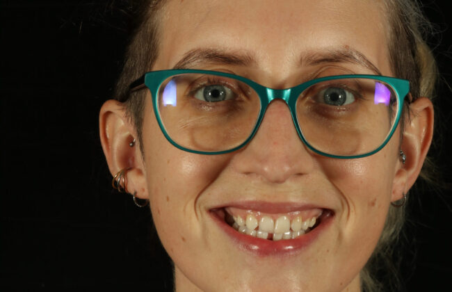 Before (Teeth)