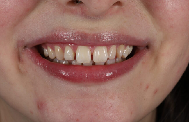 Before