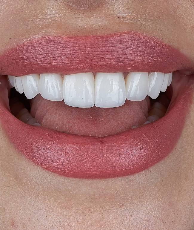 Treatments - Smile Society