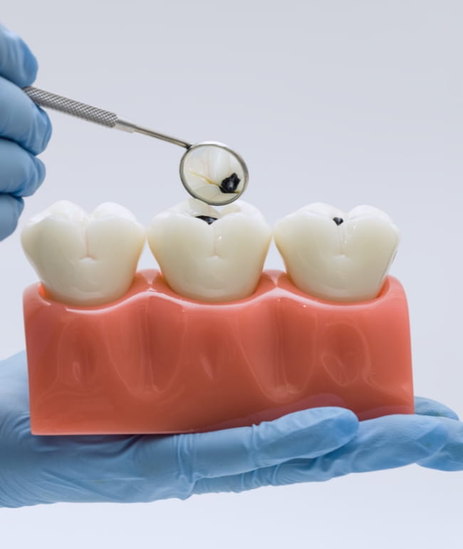 Treatments - Smile Society