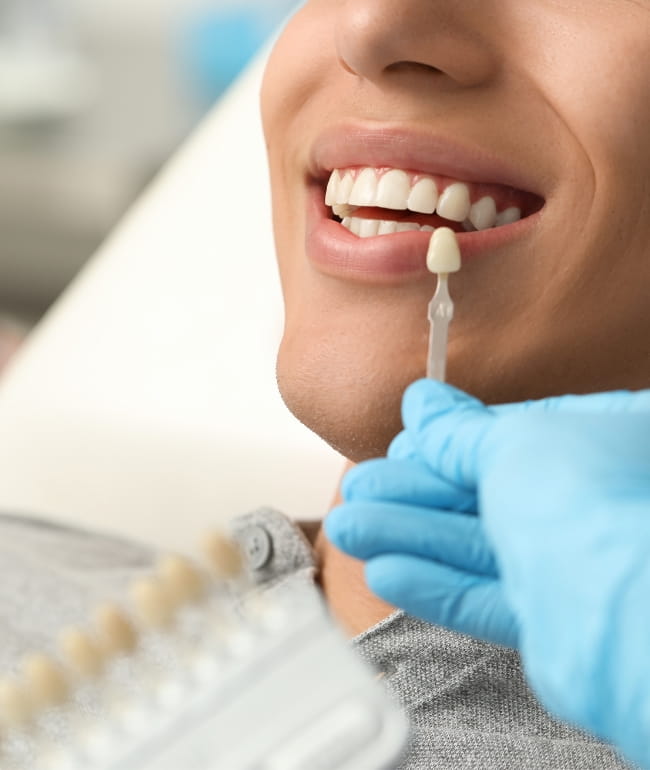 Treatments - Smile Society