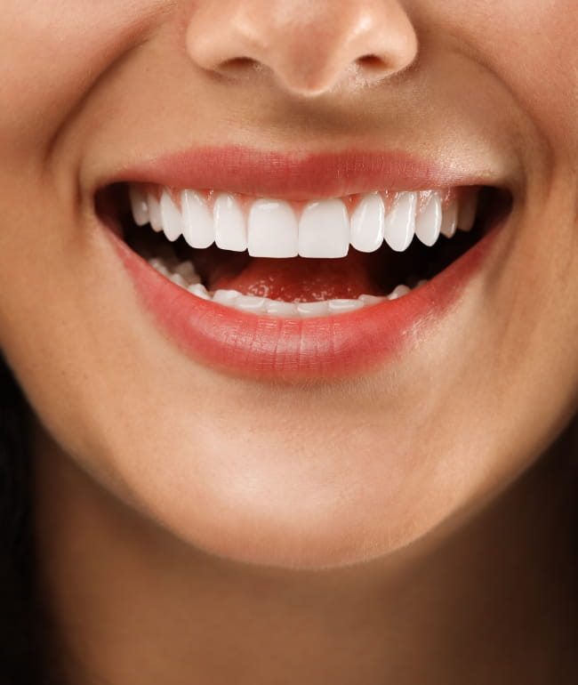 Treatments - Smile Society