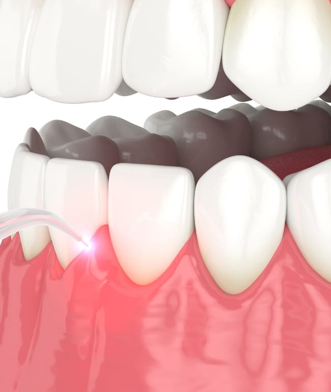 Treatments - Smile Society